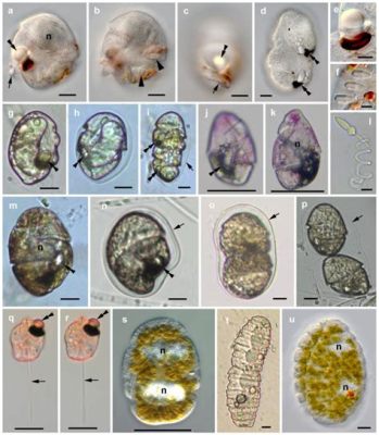  インフゾリア: 単細胞の生き物でさえ、驚くべき適応力と複雑さを持っているとは！